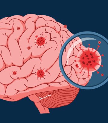 Long COVID is Not Psychosomatic